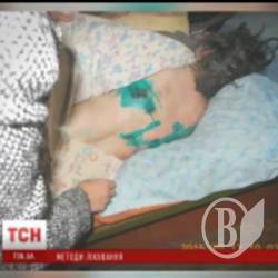 В психушках на Черниговщине пациенты спали в собственных испражнениях и работали до 11 часов в сутки В психушках на Черниговщине пациенты спали в собственных испражнениях и работали до 11 часов в сутки