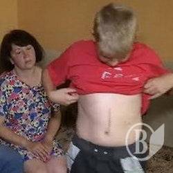 Школяр відбив селезінку на уроку фізкультури Школяр відбив селезінку на уроку фізкультури