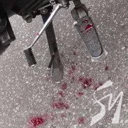 Гаряча кров мотоцикліста окропила асфальт проспекту Миру в Чернігові Гаряча кров мотоцикліста окропила асфальт проспекту Миру в Чернігові