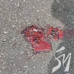 Тролейбус збив велосипедиста Тролейбус збив велосипедиста
