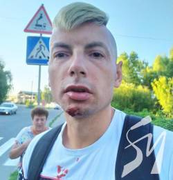 У Чернігові підступно побили блогера Ігоря Стаха У Чернігові підступно побили блогера Ігоря Стаха