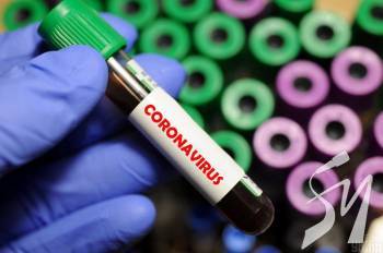 COVID-19 � ������: �� ���� ������� 2 174 ������